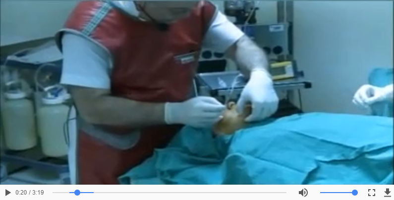 İbrahim Yegül - Mandibuler RT