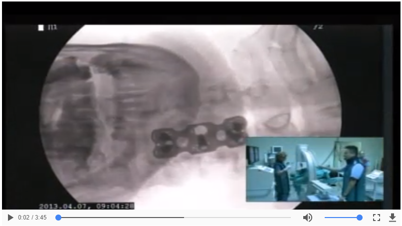 Meltem Uyar - Servikal DRG